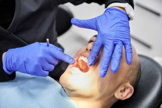 Best Emergency Wisdom Tooth Extraction in Kiefer, OK
