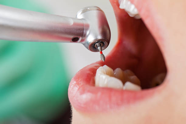 Best Emergency Root Canal Therapy in Kiefer, OK
